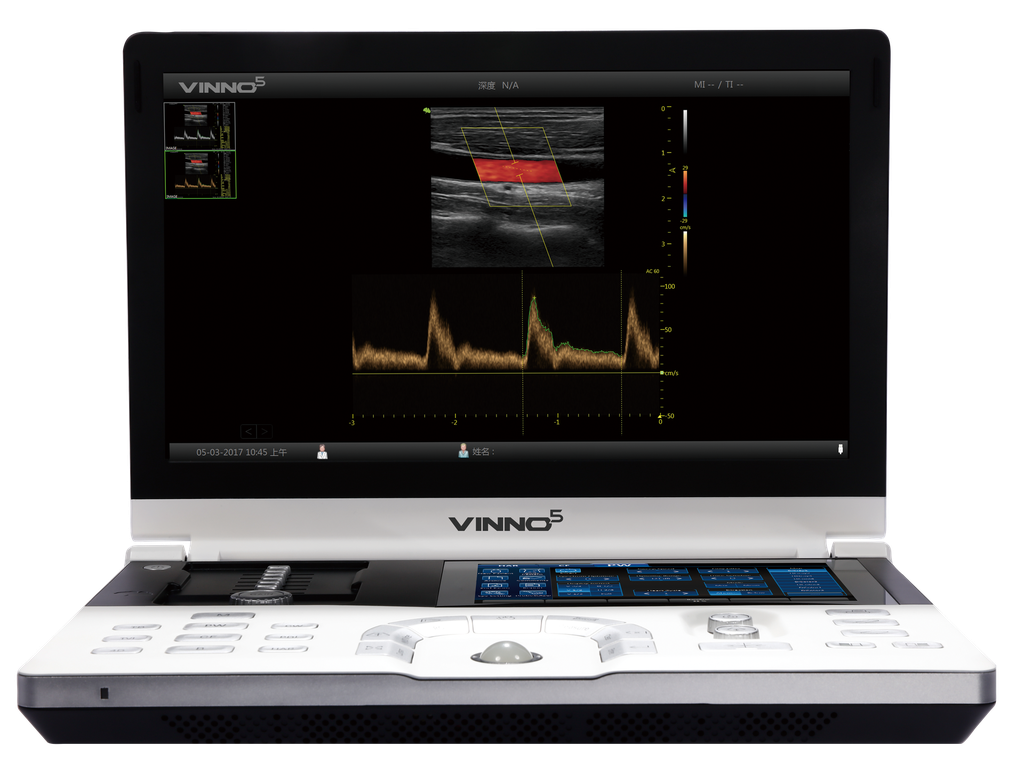 [351010] VINNO 5 VET Portable Ultrasound Unit