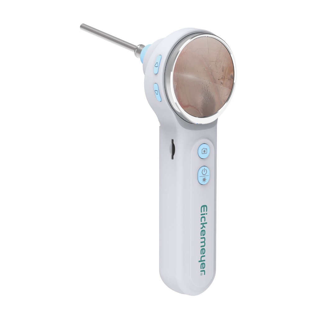 EickView OTO - Digitales Video-Otoskop