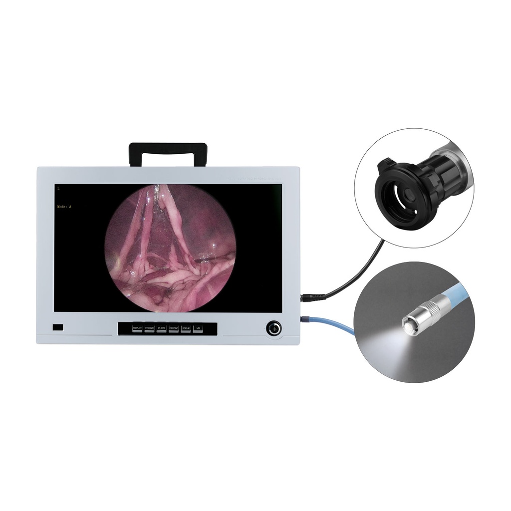 Endoskopie Monitor 22", Full HD mit integrierter CCD Kamera und Lichtquelle1/2 " CMOS Full HD, 60fps 100W LED Lichtquelle, 5000-6500K Farbtemperatur