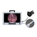 Endoskopie Monitor 22", Full HD mit integrierter CCD Kamera und Lichtquelle1/2 " CMOS Full HD, 60fps 100W LED Lichtquelle, 5000-6500K Farbtemperatur