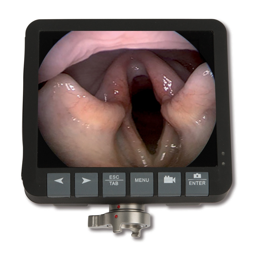 3,5" Aufsetzmonitor für Eickview 60, 70, 100E, 150E